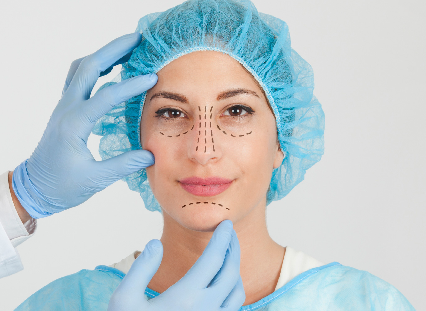 Facelift Surgery